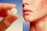 Contraceptivos hormonais e alterações da pele 