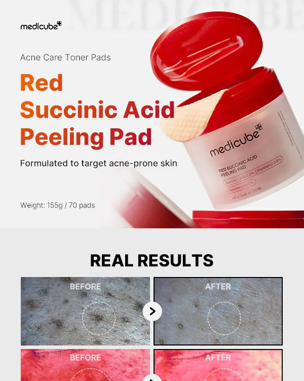 Red Succinic Acid Peeling Pad [70ea]